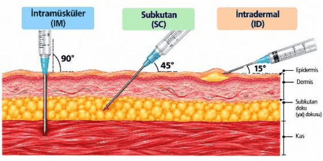 Şekil 1: Aşıların enjeksiyon ile uygulama yöntemleri. İntramüsküler (IM) enjeksiyon 90°, subkutan (SC) 45°, intradermal (ID) 15° açıyla; deri katmanları epidermis, dermis, subkutan doku (yağ dokusu) ve kas.