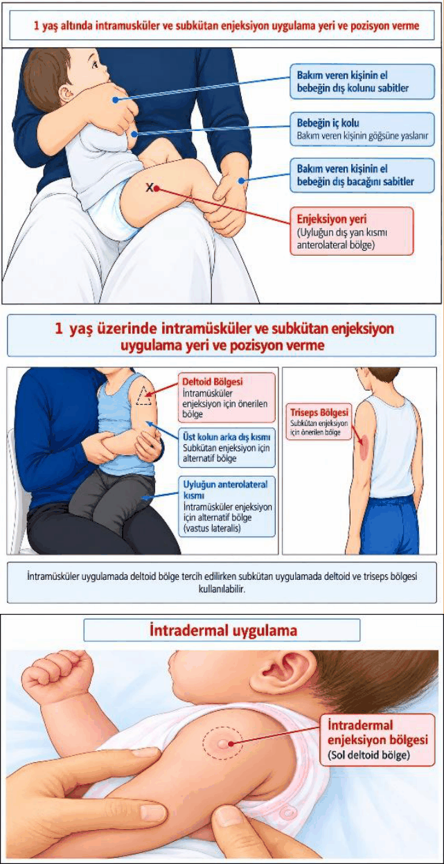 Şekil 2: Aşıların uygulama bölgeleri. 1 yaş altında intramüsküler ve subkütan enjeksiyon: bebek bakım veren kişinin kucağında tutulur, enjeksiyon yeri uyluğun dış yan kısmı (anterolateral bölge). 1 yaş üzerinde: deltoid bölge (intramüsküler), üst kolun arka dış kısmı ve triseps bölgesi (subkütan), uyluğun anterolateral kısmı (vastus lateralis, intramüsküler için alternatif). İntradermal uygulama: sol deltoid bölge.